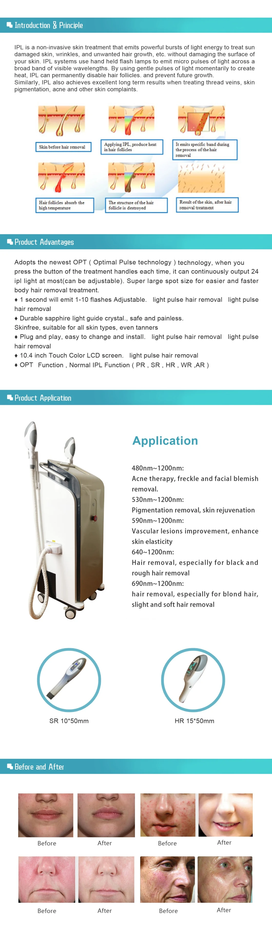 Opt IPL Elight Hair Removal Treatment Acne Removal Beauty Machine