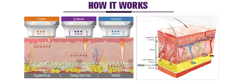 Promotion Price 3D Hifu Anti-Wrinkle Removal Hifu Face Lifting Machine