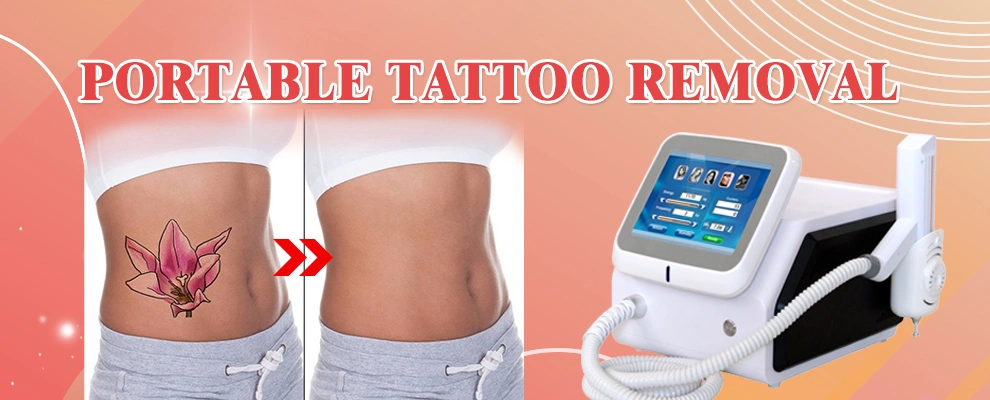 Beauty Laser Treatment Equipment Q Switched ND YAG Laser Pico Pigment Tattoo Removal Machine