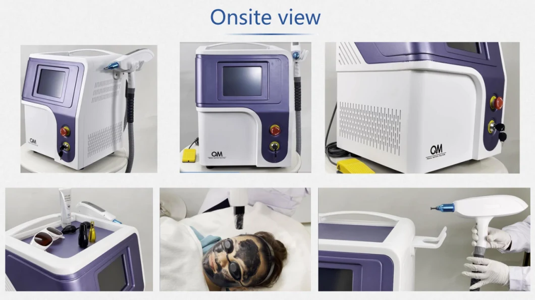 Portable Q-Switch ND: YAG Laser Tattoo Removal Pigmentation Removal Carbon Peeling Machine